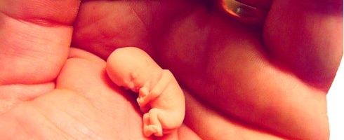 Fetus Heartbeats: A Timeline