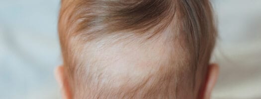 Baby Hair Loss: A Guide for New Parents