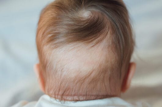 Baby Hair Loss: A Guide for New Parents