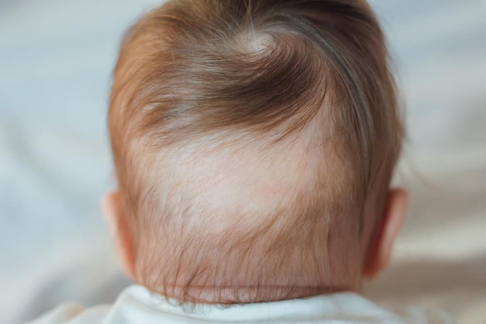 Baby Hair Loss Everything New Parents Need to Know