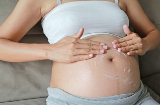 Best Pregnancy Stretch Mark Creams and Oils