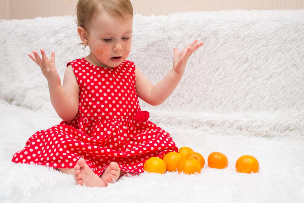 little girl with skin conditions sits with citrus fruits