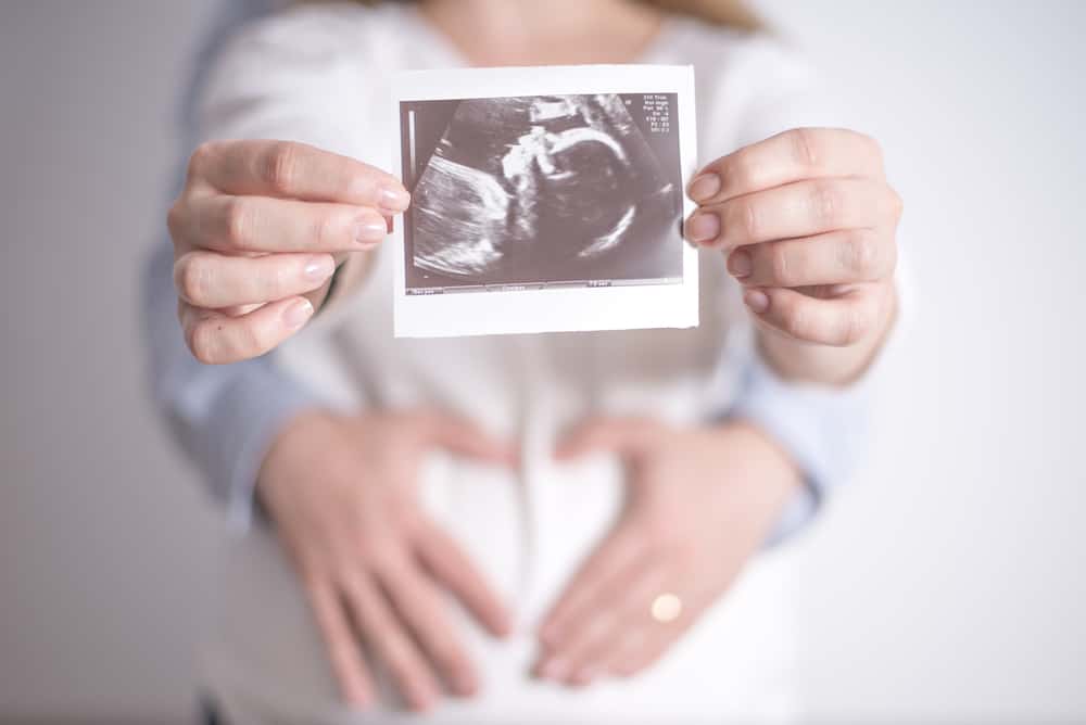 woman holding ultrasound