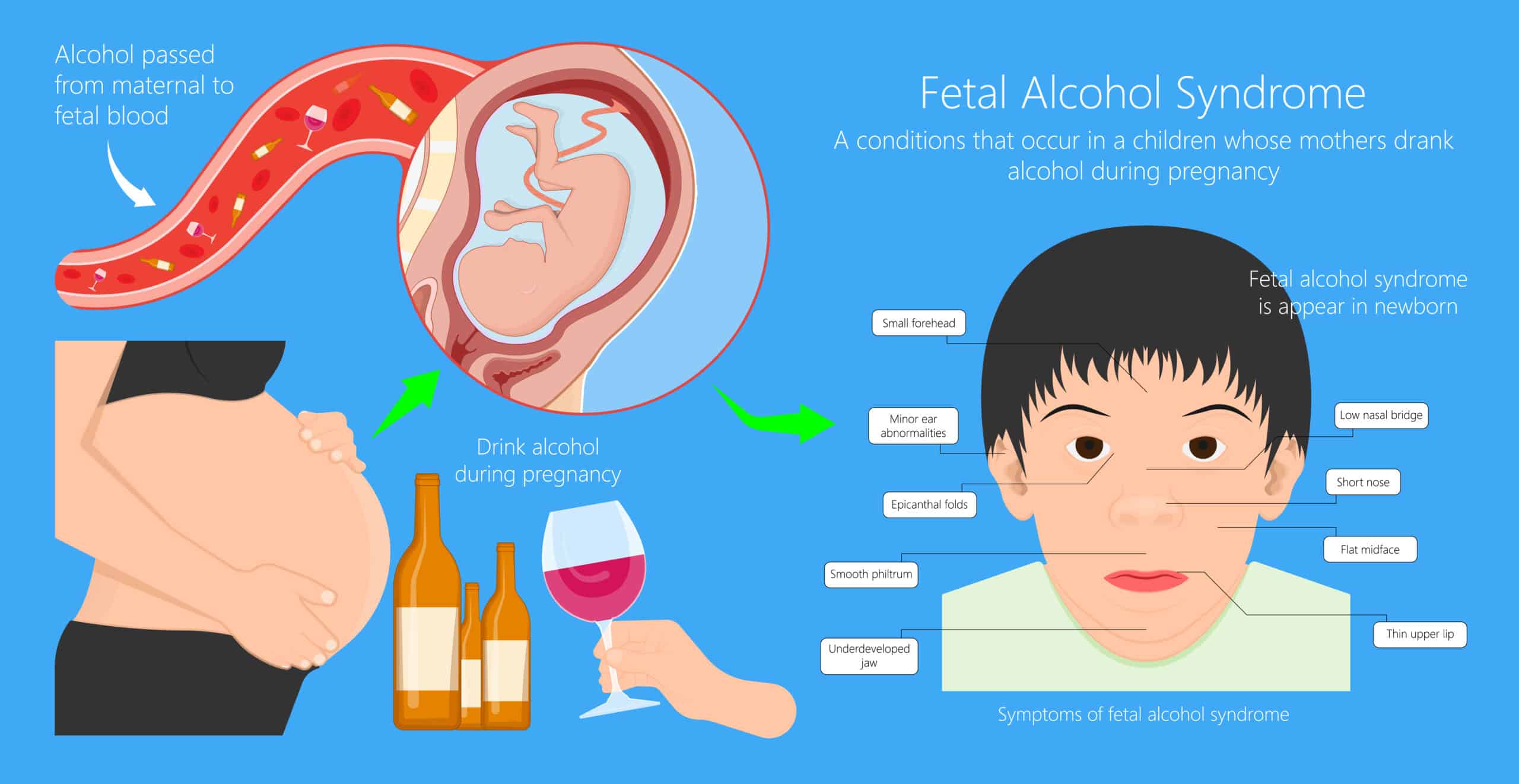 an infographic outlining the various issues associated with FASD