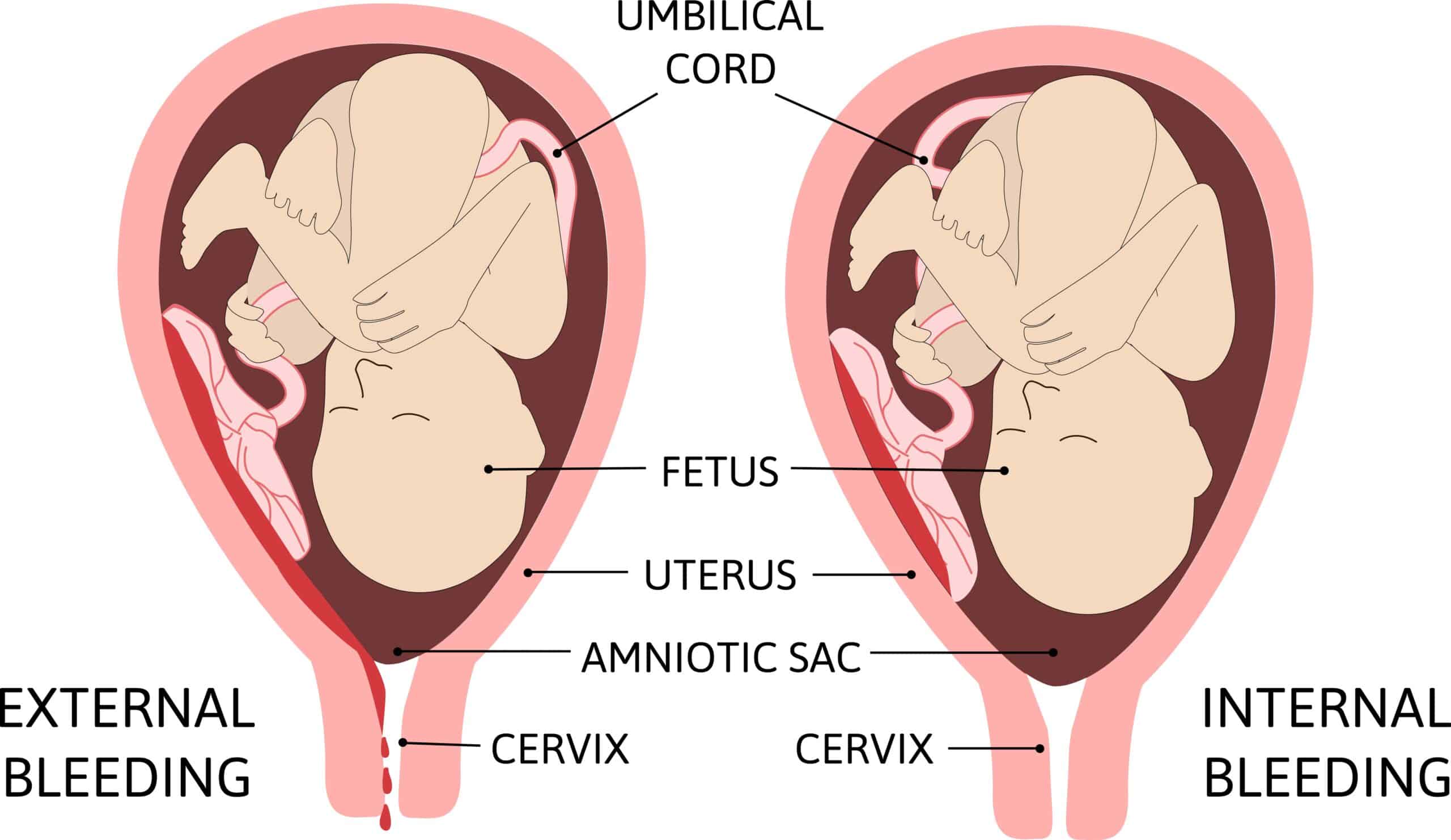 child in womb diagram