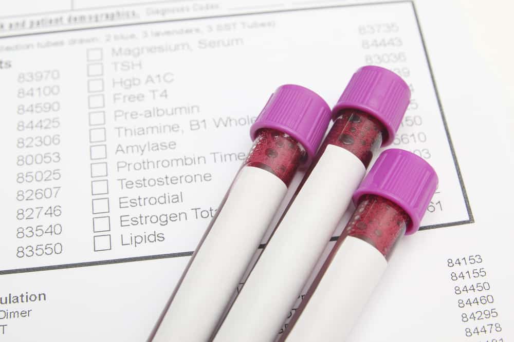 three vials of blood on a blood test biochemistry form
