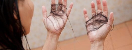 Suffering From Postpartum Hair Loss?